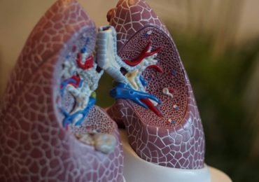 What are the Signs of a Pulmonary Embolism and How to Treat It