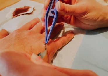 How Much Does It Cost To Start A Case After A Personal Injury