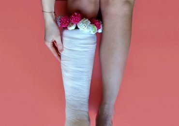 Exploring the Psychological Impact of Leg Injuries from Car Accidents